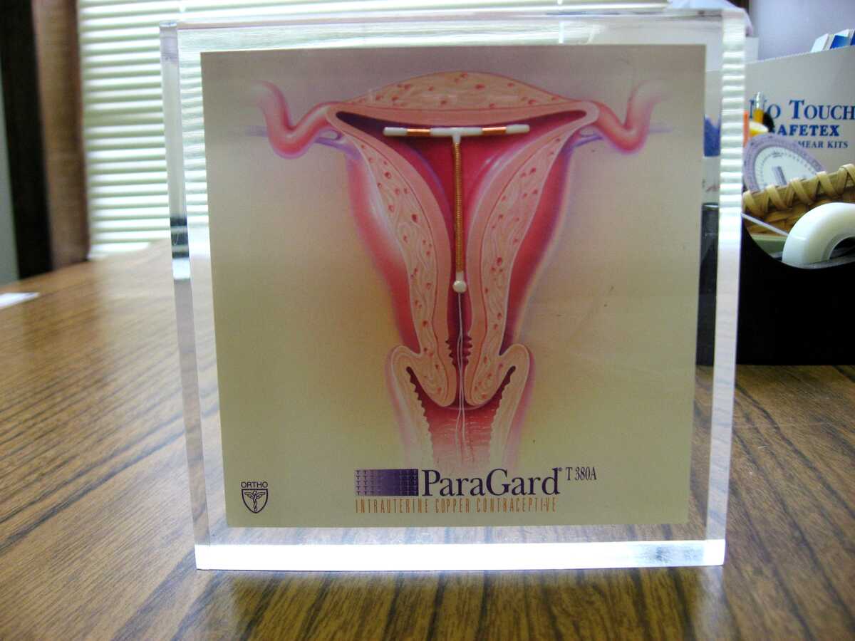 IUD in utero, photo by lobstar28 at flickr.com